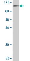 Anti-RNF103 Mouse Monoclonal Antibody [clone: 1C1]