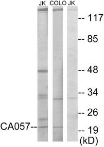 Western blot analysis of lysates from Jurkat and COLO205 cells using Anti-C1orf57 Antibody The right hand lane represents a negative control, where the antibody is blocked by the immunising peptide