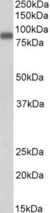 EB09730 (0.1 µg/ml) staining of Peripheral Blood Mononucleocytes lysate (35 µg protein in RIPA buffer). Primary incubation was 1 hour. Detected by chemiluminescence.