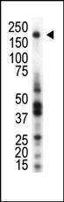 Anti-MST1R Rabbit Polyclonal Antibody (Biotin)