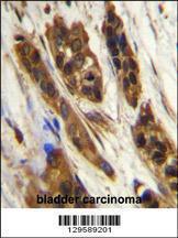 Anti-SNR27 Rabbit Polyclonal Antibody (HRP (Horseradish Peroxidase))