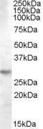 Anti-YWHAQ Antibody (A84422) (0.03µg/ml) staining of Human Brain (Hippocampus) lysate (35µg protein in RIPA buffer). Primary incubation was 1 hour. Detected by chemiluminescence.