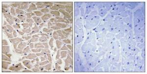 Immunohistochemical analysis of paraffin-embedded human heart tissue using Anti-Collagen XVI alpha1 Antibody. The right hand panel represents a negative control, where the antibody was pre-incubated with the immunising peptide