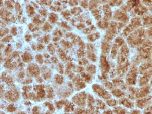 Anti-CELA3B Mouse Monoclonal Antibody [clone: CELA3B/1257]