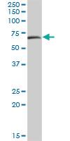 Anti-MAOA Mouse Polyclonal Antibody