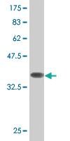 Anti-FXN Mouse Monoclonal Antibody [clone: 3C3]