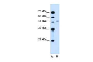 Anti-MGAT2 Rabbit Polyclonal Antibody