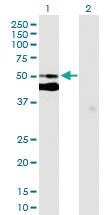 Anti-SUGCT Mouse Polyclonal Antibody