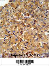 Anti-SFT2D3 Rabbit Polyclonal Antibody