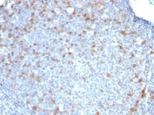 Immunohistochemical analysis of formalin-fixed, paraffin-embedded human tonsil using Anti-CDC20 Antibody [CDC20/1102]