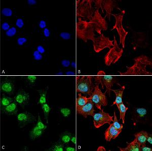 Anti-Adenosine A1 Receptor antibody