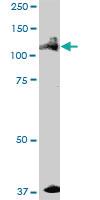 Anti-ALPK1 Mouse Polyclonal Antibody