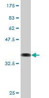 Anti-FXN Mouse Monoclonal Antibody [clone: 3E7]