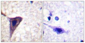 Immunohistochemical analysis of paraffin-embedded human brain using Anti-BID (phospho Ser78) Antibody. The right hand panel represents a negative control, where the antibody was pre-incubated with the immunising peptide