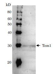 Anti-Tem1 Antibod