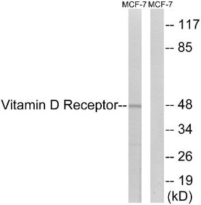 Western blot analysis of lysates from MCF-7 cells using Anti-Vita min D Receptor Antibody. The right hand lane represents a negative control, where the Antibody is blocked by the immunising peptide