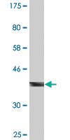 Anti-CBL Mouse Monoclonal Antibody [clone: 6D12]