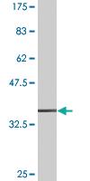 Anti-FXN Mouse Monoclonal Antibody [clone: 5D4]