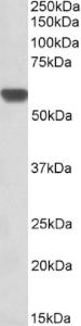 EB09738 (0.3 µg/ml) staining of Human Heart lysate (35 µg protein in RIPA buffer). Primary incubation was 1 hour. Detected by chemiluminescence.