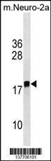 Anti-LDOC1L Rabbit Polyclonal Antibody (HRP (Horseradish Peroxidase))