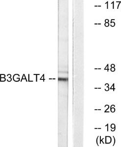 Anti-B3GALT4 Rabbit Polyclonal Antibody