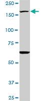 Anti-KDM5B Mouse Monoclonal Antibody [clone: 1G10]