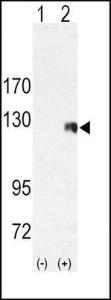 Anti-ROR2 Rabbit Polyclonal Antibody (APC (Allophycocyanin))