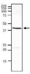 Anti-Rnq1 antibody