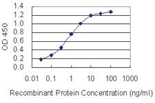 Anti-RPGRIP1 Mouse Monoclonal Antibody [clone: 5H2]