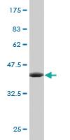 Anti-FXN Mouse Monoclonal Antibody [clone: 5E3]