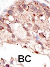 Anti-SUV39H2 Rabbit Polyclonal Antibody (HRP (Horseradish Peroxidase))