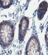 Anti-CASP1 Rabbit polyclonal antibody