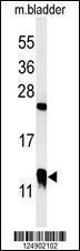 Anti-CRIP1 Rabbit Polyclonal Antibody (FITC (Fluorescein Isothiocyanate))