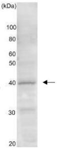 Anti-Gtr2 Antibody