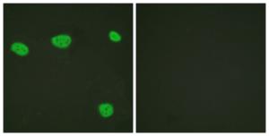 Immunofluorescence analysis of HeLa cells using Anti-Vita min D Receptor Antibody. The right hand panel represents a negative control, where the Antibody was pre-incubated with the immunising peptide