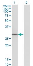 Anti-GOSR1 Mouse Monoclonal Antibody [clone: 2C2]