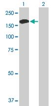 Anti-ALPK1 Mouse Polyclonal Antibody