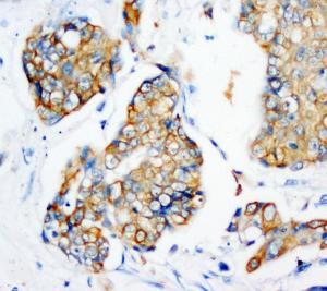 Anti-Cytokeratin Peptide 18 Mouse Monoclonal Antibody [clone: CK-18]