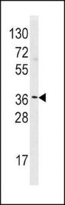 Anti-HNMT Rabbit Polyclonal Antibody (FITC (Fluorescein))