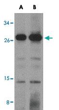 Anti-OCIAD1 Rabbit Polyclonal Antibody