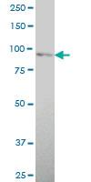 Anti-TLR2 Mouse Monoclonal Antibody [clone: 3E3]