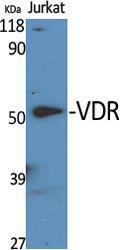 Western blot analysis of various cells using Anti-Vita min D Receptor Antibody