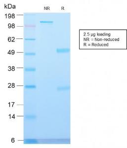 SDS-PAGE analysis of Anti-Major Vault Protein Antibody [VP2897R] under non-reduced and reduced conditions; showing intact IgG and intact heavy and light chains, respectively. SDS-PAGE analysis confirms the integrity and purity of the antibody