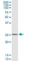 Anti-FXN Antibody Pair