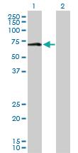 Anti-MAOA Rabbit Polyclonal Antibody