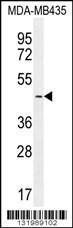 Anti-LEF1 Rabbit Polyclonal Antibody (AP (Alkaline Phosphatase))