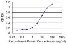 Anti-GOSR1 Mouse Monoclonal Antibody [clone: 2C2]