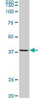 Anti-AVEN Mouse Monoclonal Antibody [clone: 2B10]