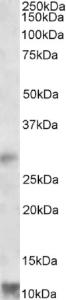 EB09769 (1 µg/ml) staining of Human Heart lysate (35 µg protein in RIPA buffer). Primary incubation was 1 hour. Detected by chemiluminescence.