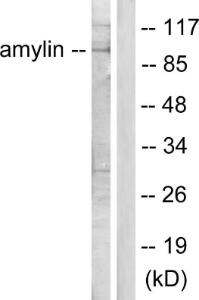 Western blot analysis of lysates from HeLa cells, treated with EGF 200 ng/ml 30' using Anti-Amylin Antibody. The right hand lane represents a negative control, where the Antibody is blocked by the immunising peptide